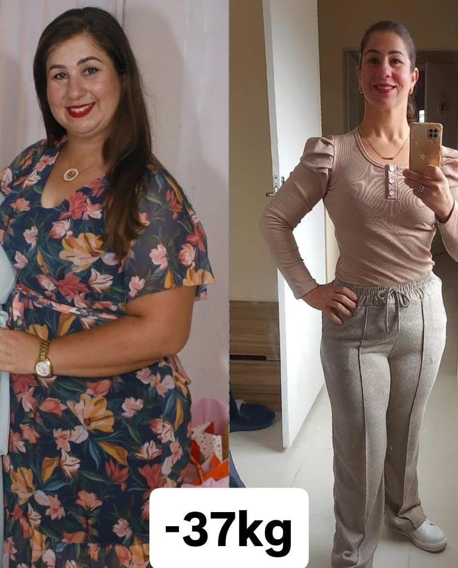 Aluna antes e depois, com 37 kg a menos