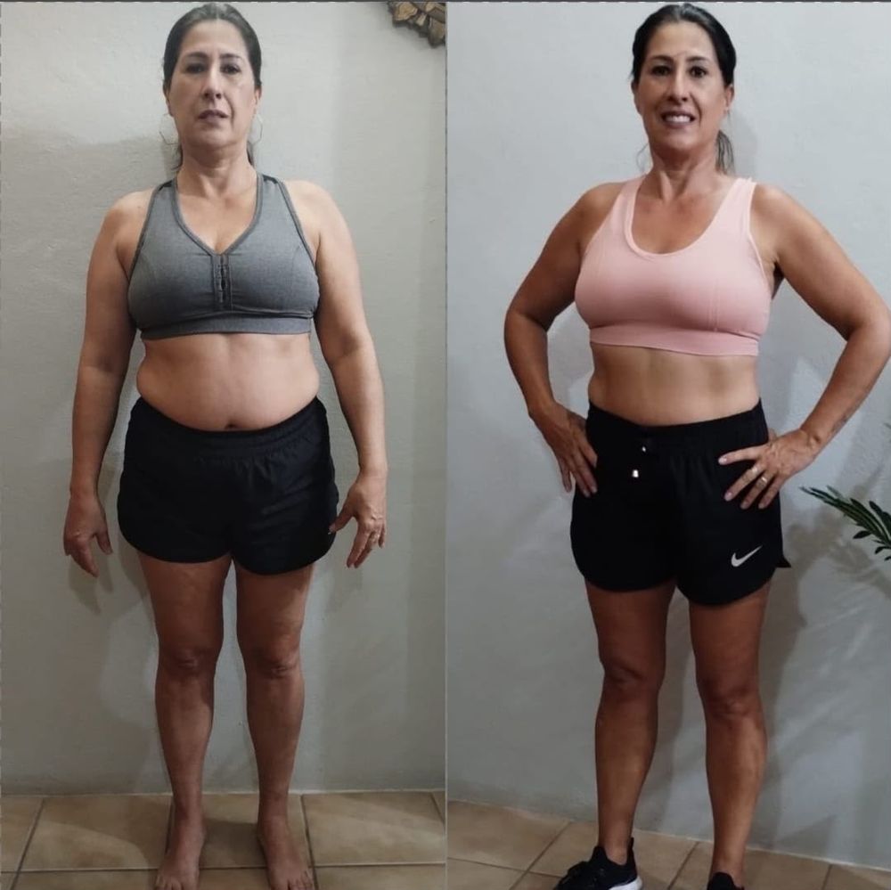 Aluna antes e depois, de frente, com a cintura mais fina