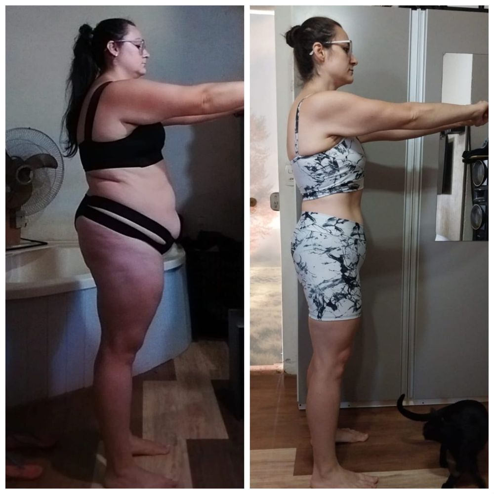Aluna antes e depois, de perfil, com barriga bem menor
